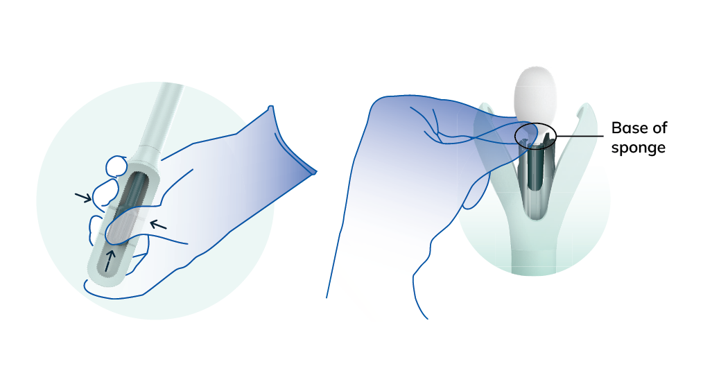 How to remove sponge from Wand